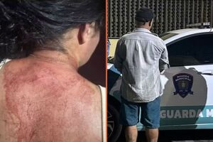 A v&iacute;tima foi atendida em um hospital e precisou levar pontos na cabe&ccedil;a.