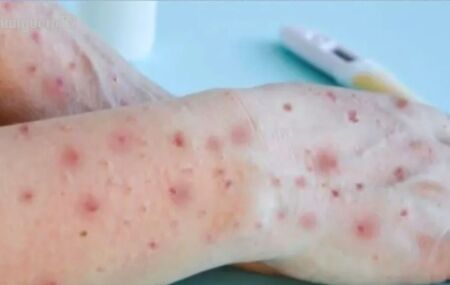 Var&iacute;ola dos Macacos.