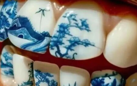 Tatuagem nos dentes vira febre
