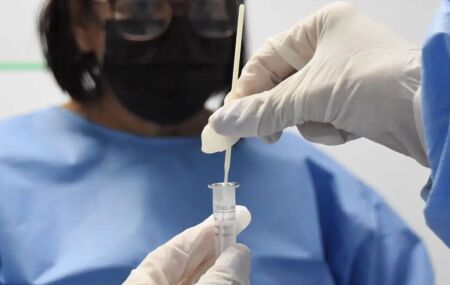 M&eacute;dicos com amostra de Covid-19.