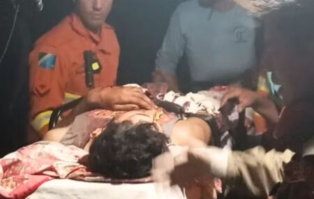 Homem que foi atacado por on&ccedil;a.