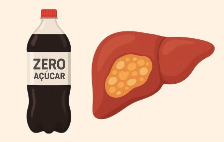 Refrigerante e Gordura no F&iacute;gado