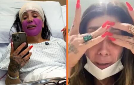 Rosto da influenciadora Maya Massafera infecciona ap&oacute;s cirurgia: "N&atilde;o consigo parar de chorar"