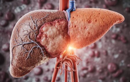 Gordura no f&iacute;gado pode ser revertida em 3 a 6 meses com h&aacute;bitos saud&aacute;veis. 