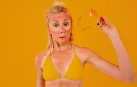 O sol pode acelerar o envelhecimento da pele sem que voc&ecirc; perceba. 