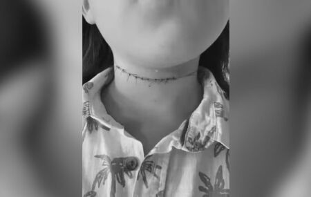 Crian&ccedil;a &eacute; atingida por linha com cerol no pesco&ccedil;o.