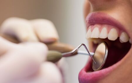 Maconha faz mal para os dentes. 