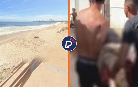 Praia Del Chifre, em Olinda e pessoas carregando adolescente atacado por tubar&atilde;o.