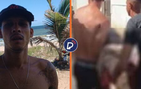 Andr&eacute; Sthwart, sobrevivente de ataque de tubar&atilde;o em Olinda.