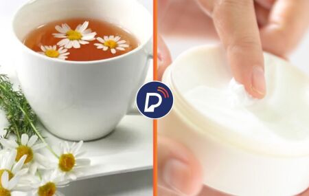 Ch&aacute; de Camomila e pomada.