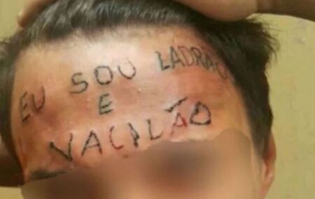 Testa de Ruan Rocha da Silva, na &eacute;poca em que teve a testa tatuada.