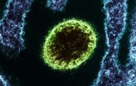 V&iacute;rus isolado Nipah observado em laborat&oacute;rio. 