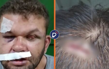 Dupla formada por homem cego e seu irm&atilde;o &eacute; agredida por vigilante durante briga por marmita