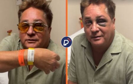 Leonardo aparece com olho roxo ap&oacute;s pescaria no Pantanal: "N&atilde;o t&aacute; muito Bonito, n&atilde;o, n&eacute;?"