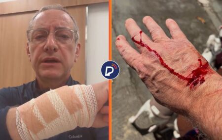 Segundo relatos do comunicador em suas redes sociais, uma mulher passeava com tr&ecirc;s cachorros, mas o de maior agressividade estava totalmente livre.