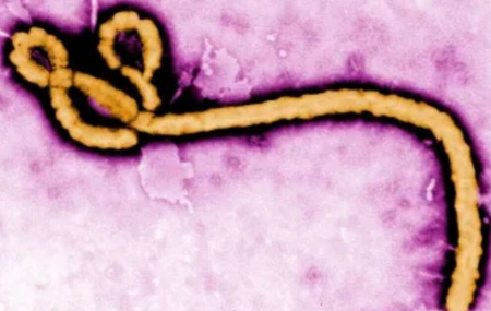 Suspeita de ebola em imigrante da Rep&uacute;blica Democr&aacute;tica do Congo &eacute; descartada ap&oacute;s exames