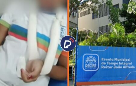 Uma estudante de 14 anos perdeu parte do dedo m&eacute;dio da m&atilde;o esquerda ap&oacute;s prend&ecirc;-lo na porta do banheiro da Escola Municipal de Tempo Integral (EMTI) Reitor Jo&atilde;o Alfredo. 
