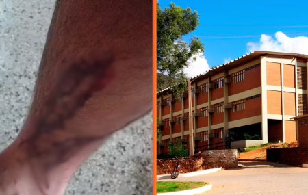 UFRPE &eacute; condenada a pagar R$ 10 mil a estudante atacado por c&atilde;es em universidade