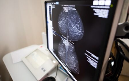 Hospital da Mulher do Recife ter&aacute; capacidade para 600 mamografias por m&ecirc;s com novo equipamento.