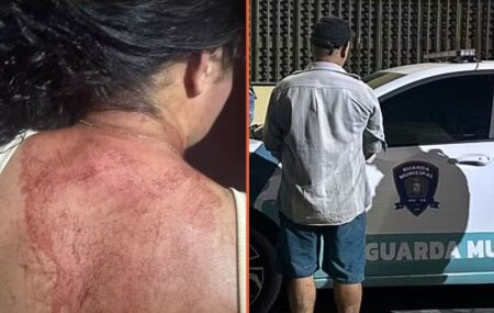 A v&iacute;tima foi atendida em um hospital e precisou levar pontos na cabe&ccedil;a.