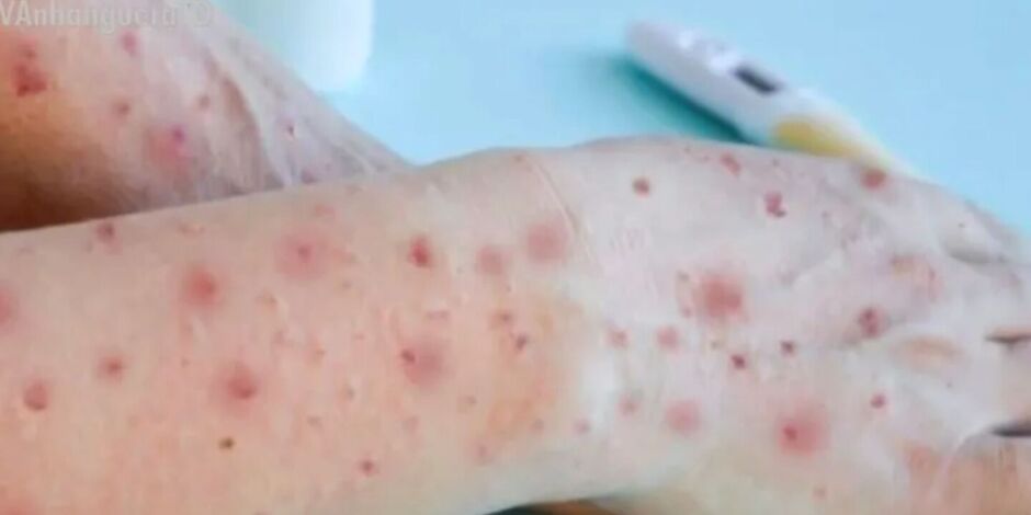 Var&iacute;ola dos Macacos.