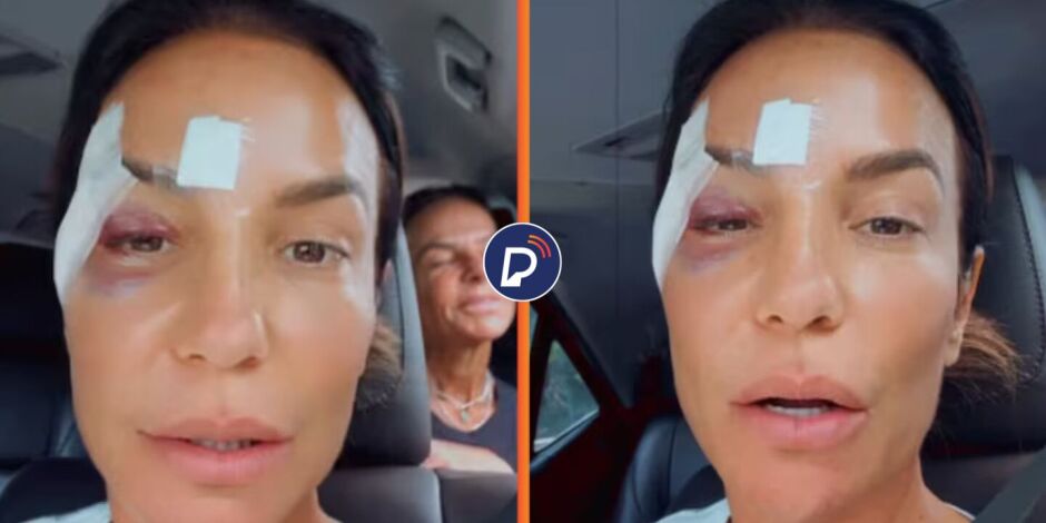 Ivete Sangalo recebe alta hospitalar e revela diagn&oacute;stico de s&iacute;ndrome vasovagal