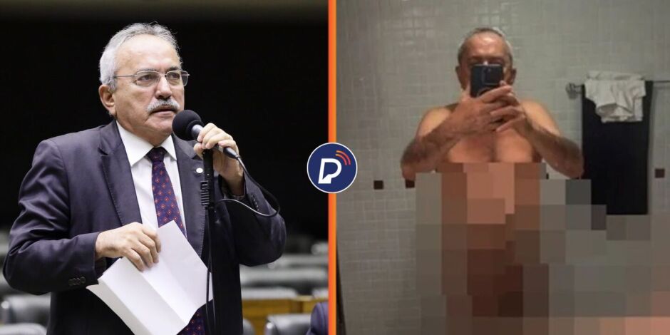 Ex-deputado federal publica imagem &iacute;ntima acidentalmente em rede social