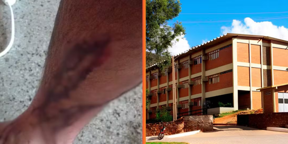 UFRPE &eacute; condenada a pagar R$ 10 mil a estudante atacado por c&atilde;es em universidade